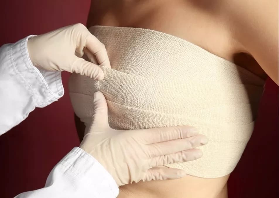 Langzeitwirkung des inneren BHs: Wie die Bruststraffung natürliche Stabilität und Halt bietet